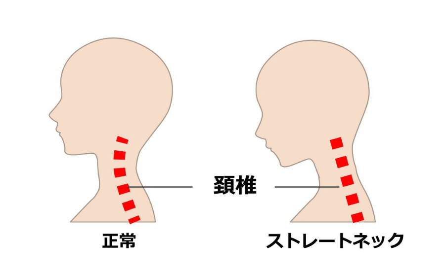 解剖学
